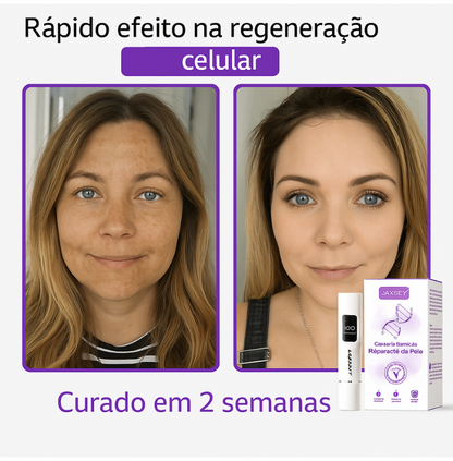 𝐉𝐚𝐬𝐬𝐞𝐞𝐦® Caneta laser para correção da pele
