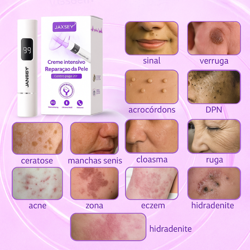 𝐉𝐚𝐬𝐬𝐞𝐞𝐦® Caneta laser para correção da pele