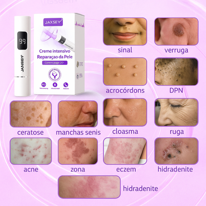 𝐉𝐚𝐬𝐬𝐞𝐞𝐦® Caneta laser para correção da pele